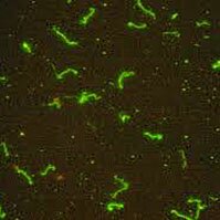 лептоспира